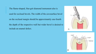 The flame-shaped, fine-grit diamond instrument also is
used for occlusal bevels. The width of the cavosurface bevel
on the occlusal margin should be approximately one-fourth
the depth of the respective wall but wider bevel is desired to
include an enamel defect.
 