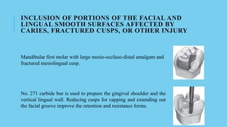 INCLUSION OF PORTIONS OF THE FACIAL AND
LINGUAL SMOOTH SURFACES AFFECTED BY
CARIES, FRACTURED CUSPS, OR OTHER INJURY
Mandibular first molar with large mesio-occluso-distal amalgam and
fractured mesiolingual cusp.
No. 271 carbide bur is used to prepare the gingival shoulder and the
vertical lingual wall. Reducing cusps for capping and extending out
the facial groove improve the retention and resistance forms.
 