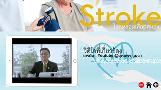 วิดีโอที่เกี่ยวข้องเครดิต : Youtube @อุทุมพร จูมจา
https://www.youtube.com/watch?v=
 