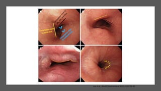Lee et al., World J Gastroenterol 2015;21(3):759-85
 