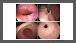 Lee et al., World J Gastroenterol 2015;21(3):759-85
 