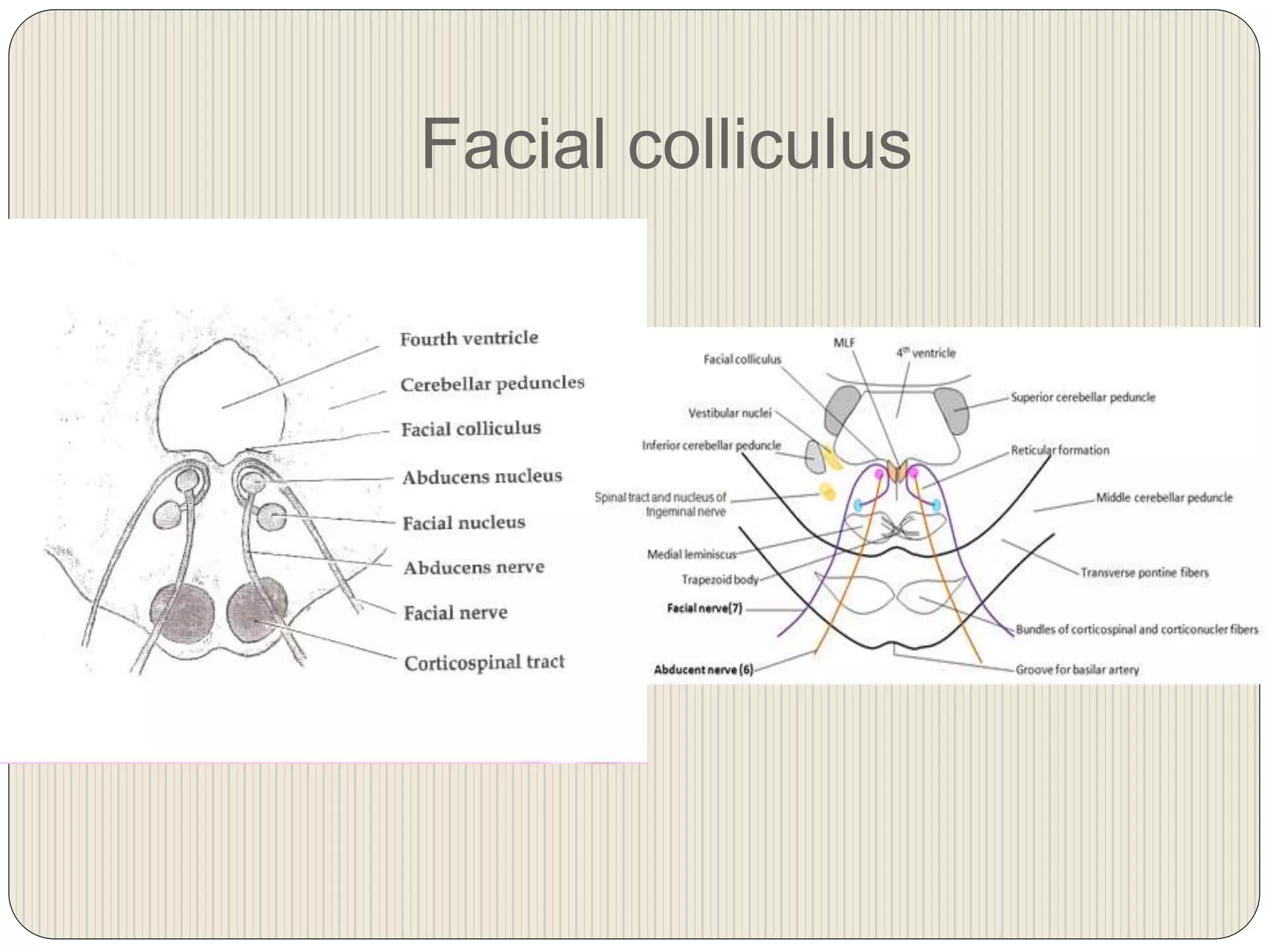 Facial colliculus
 