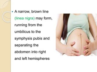  A narrow, brown line
(linea nigra) may form,
running from the
umbilicus to the
symphysis pubis and
separating the
abdomen into right
and left hemispheres
 
