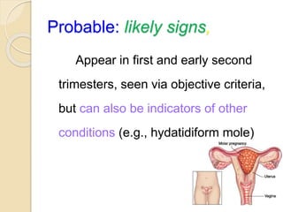 Probable: likely signs,
Appear in first and early second
trimesters, seen via objective criteria,
but can also be indicators of other
conditions (e.g., hydatidiform mole)
 