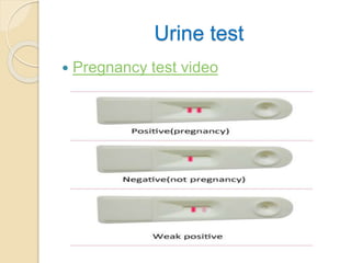 Urine test
 Pregnancy test video
 