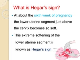 What is Hegar’s sign?
 At about the sixth week of pregnancy
the lower uterine segment just above
the cervix becomes so soft.
 This extreme softening of the
lower uterine segment is
known as Hegar’s sign
 