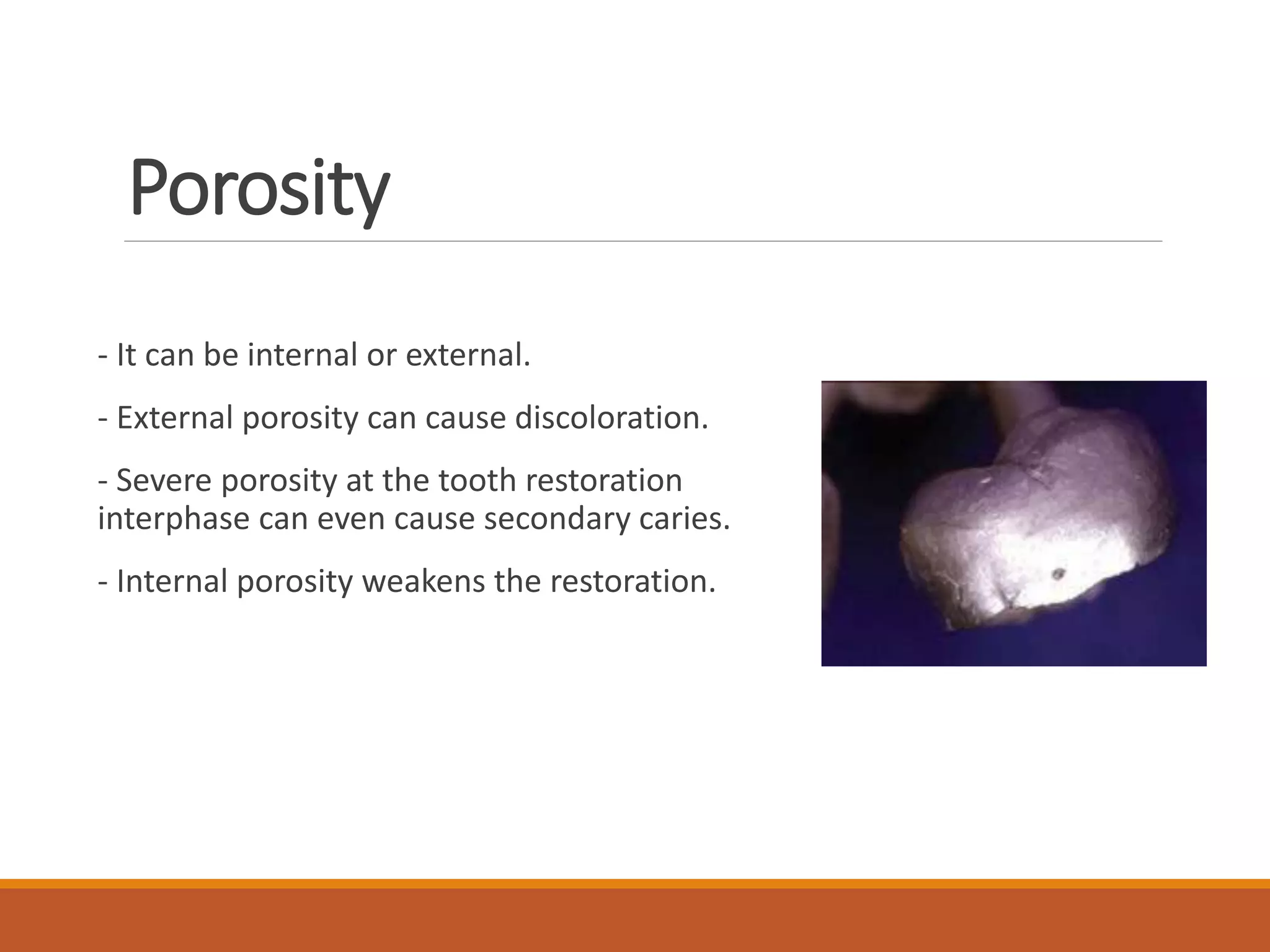 Porosity
- It can be internal or external.
- External porosity can cause discoloration.
- Severe porosity at the tooth restoration
interphase can even cause secondary caries.
- Internal porosity weakens the restoration.
 