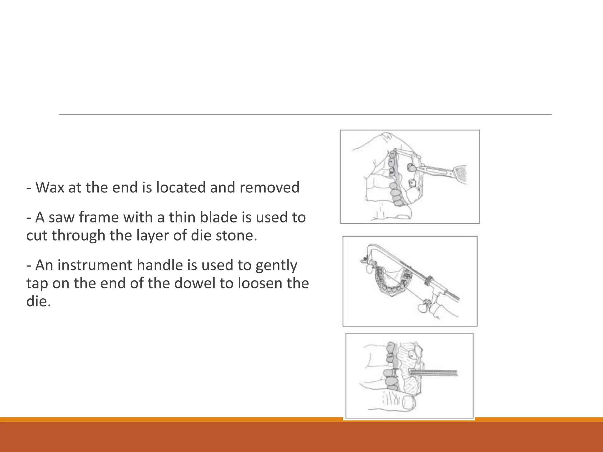 - Wax at the end is located and removed
- A saw frame with a thin blade is used to
cut through the layer of die stone.
- An instrument handle is used to gently
tap on the end of the dowel to loosen the
die.
 