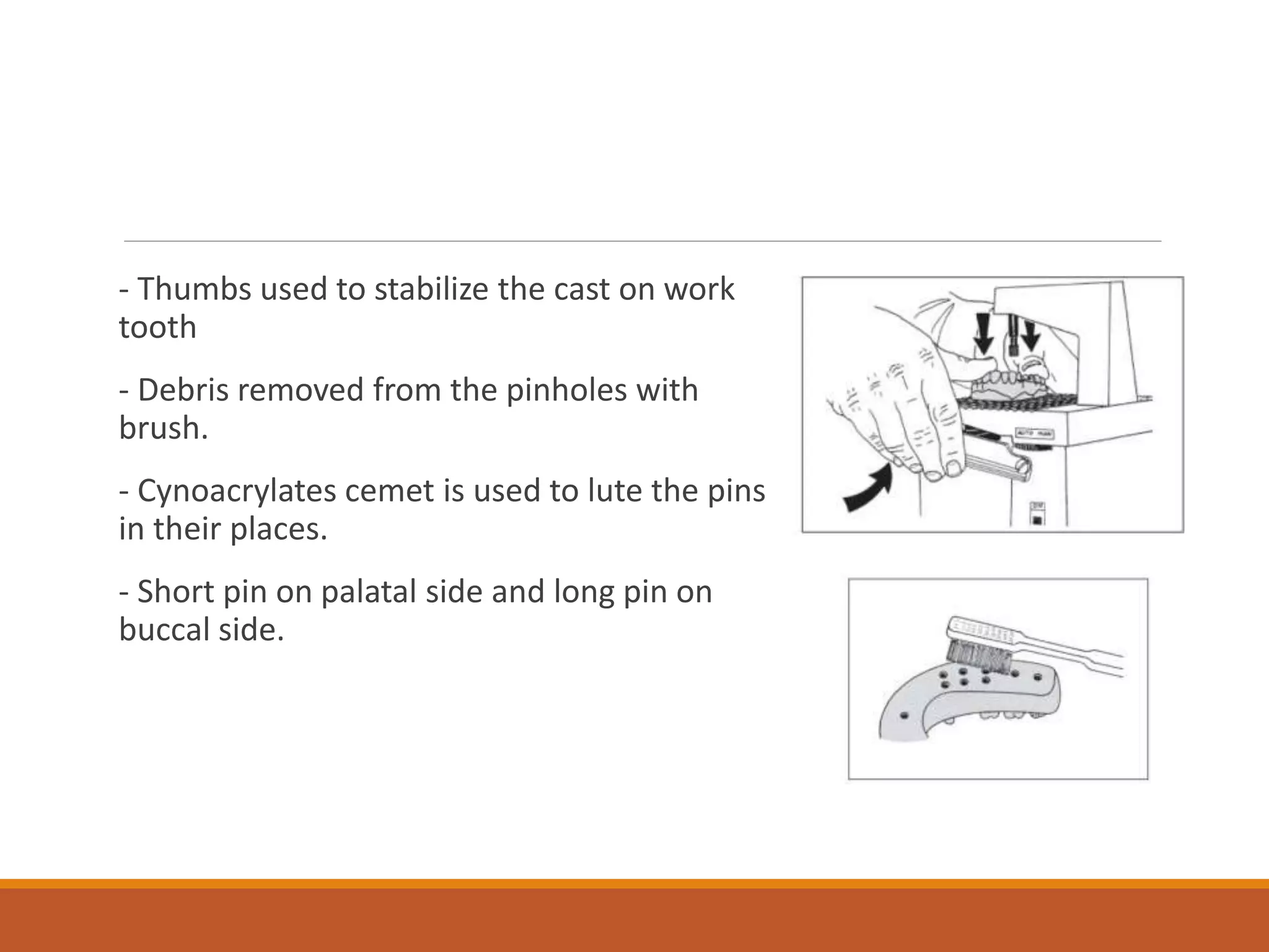 - Thumbs used to stabilize the cast on work
tooth
- Debris removed from the pinholes with
brush.
- Cynoacrylates cemet is used to lute the pins
in their places.
- Short pin on palatal side and long pin on
buccal side.
 