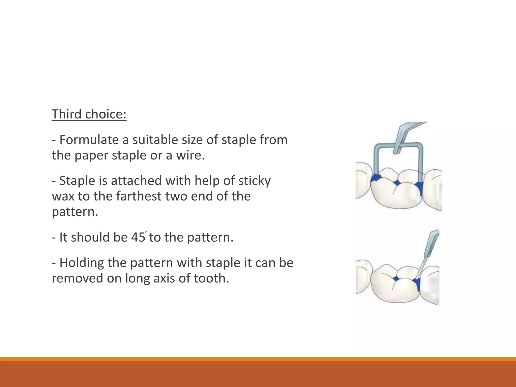 Third choice:
- Formulate a suitable size of staple from
the paper staple or a wire.
- Staple is attached with help of sticky
wax to the farthest two end of the
pattern.
- It should be 45֯ to the pattern.
- Holding the pattern with staple it can be
removed on long axis of tooth.
 