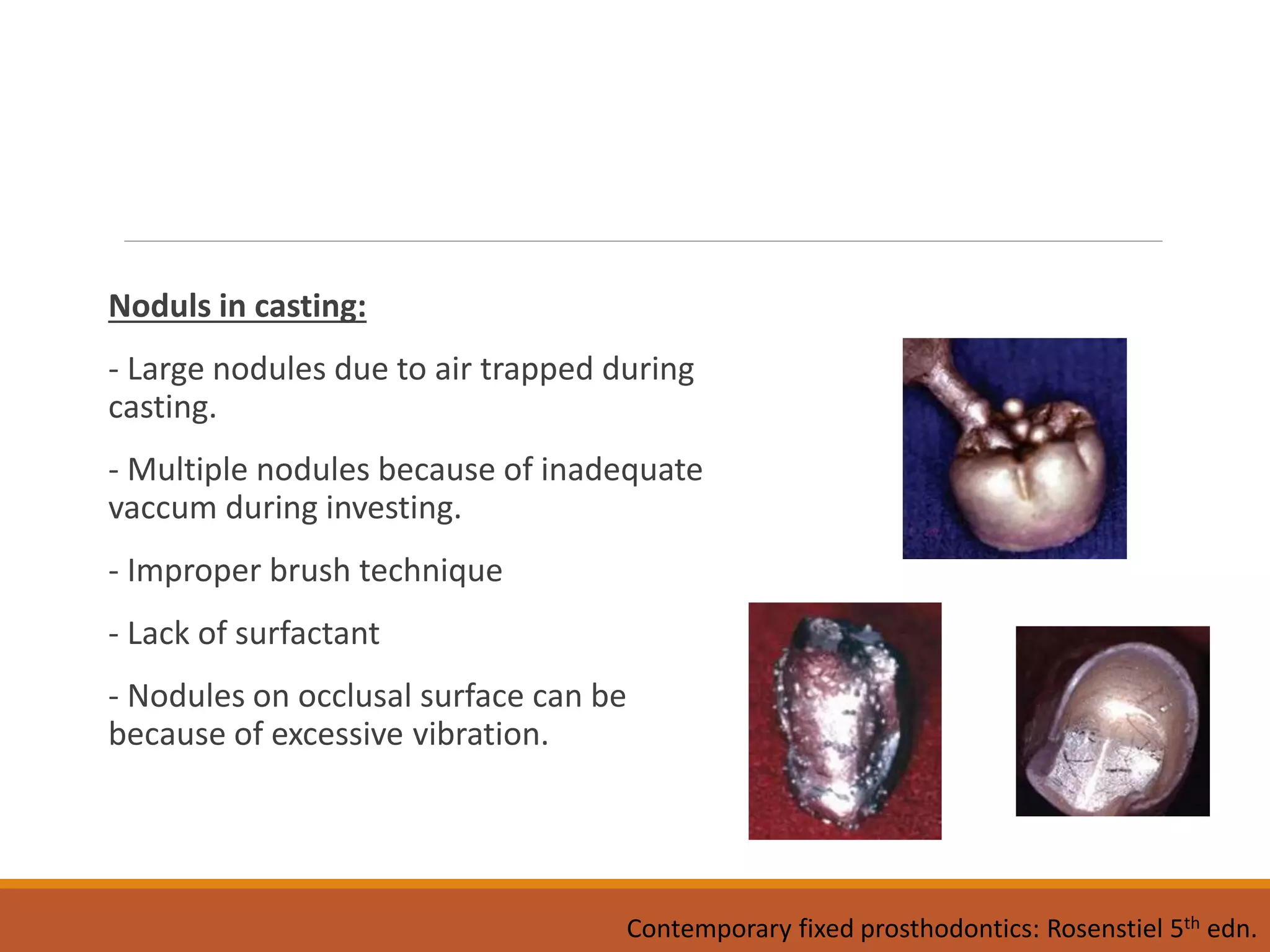Noduls in casting:
- Large nodules due to air trapped during
casting.
- Multiple nodules because of inadequate
vaccum during investing.
- Improper brush technique
- Lack of surfactant
- Nodules on occlusal surface can be
because of excessive vibration.
Contemporary fixed prosthodontics: Rosenstiel 5th edn.
 