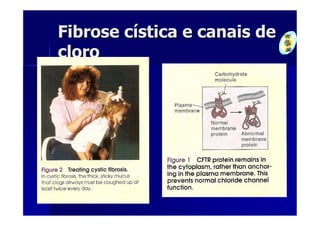 Fibrose cística e canais de
cloro
 