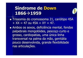 Síndrome de Down
 1866 1959
Trissomia do cromossoma 21, cariótipo 45A
+ XX = 47 ou 45A + XY = 47.
Ambos os sexos, deficiência mental, fendas
palpebrais mongolóides, pescoço curto e
grosso, cardiopatias, uma única linha
transversal na palma da mão, genitália
pouco desenvolvida, grande flexibilidade
nas articulações.
 