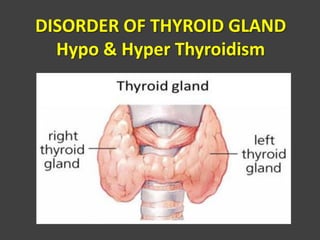DISORDER OF THYROID GLAND
Hypo & Hyper Thyroidism
 