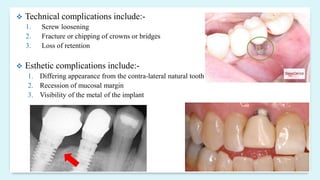  Technical complications include:-
1. Screw loosening
2. Fracture or chipping of crowns or bridges
3. Loss of retention
 Esthetic complications include:-
1. Differing appearance from the contra-lateral natural tooth
2. Recession of mucosal margin
3. Visibility of the metal of the implant
 