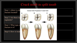 Management of Tooth fracture | PPTX