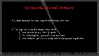 Photo inspiration: Visual Reference: Management Of Tooth Fracture