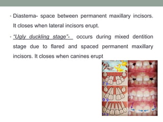 • Diastema- space between permanent maxillary incisors.
It closes when lateral incisors erupt.
• “Ugly duckling stage”- occurs during mixed dentition
stage due to flared and spaced permanent maxillary
incisors. It closes when canines erupt
 