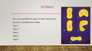 ISTHMUS
Kim et al. identified five types of isthmi that can be
found on a beveled root surface.
Type 1
Type 2
Type 3
Type 4
Type 5
Kim SY, Kim BS, Woo J, Kim Y. Morphology of mandibular first molars analyzed by cone-beam computed tomography in a Korean
population: variations in the number of roots and canals. J Endod. 2013;39:1516-21.
 