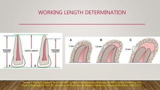 WORKING LENGTH DETERMINATION
Serene T, Krasny R, Ziegler P, et al. Principles of Preclinical Endodontics. Dubuque, IA: Kendall/Hunt Publishing; 1974.
Ingle JI, Beveridge EE, Glick DH, Weichman JA, Abou-Rass M. Modern endodontic therapy. Endodontics. 1994;2:1-57.
 
