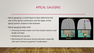 APICAL GAUGING
• Apical gauging is a technique to best determine the
size of the apical constriction and the taper of the
apical portion closest to the foramen.
• Apical gauging helps with:
 Choosing the best master cone that closely matches canal
length and taper.
 Achieving true tug back
 Minimizing GP extrusions during obturation, especially
with warm vertical compaction/ condensation.
Deutsch AS. Endodontic insight: Where should the gutta-percha point end for optimal endodontic success?; Jan 7th
 