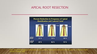 APICAL ROOT RESECTION
Color Atlas of Microsurgery in Endodontics, by S. Kim with G. Pecora and R. Rubinstein. W.B. Saunders Co., A Harcourt Health
Sciences Company, 2001.
 