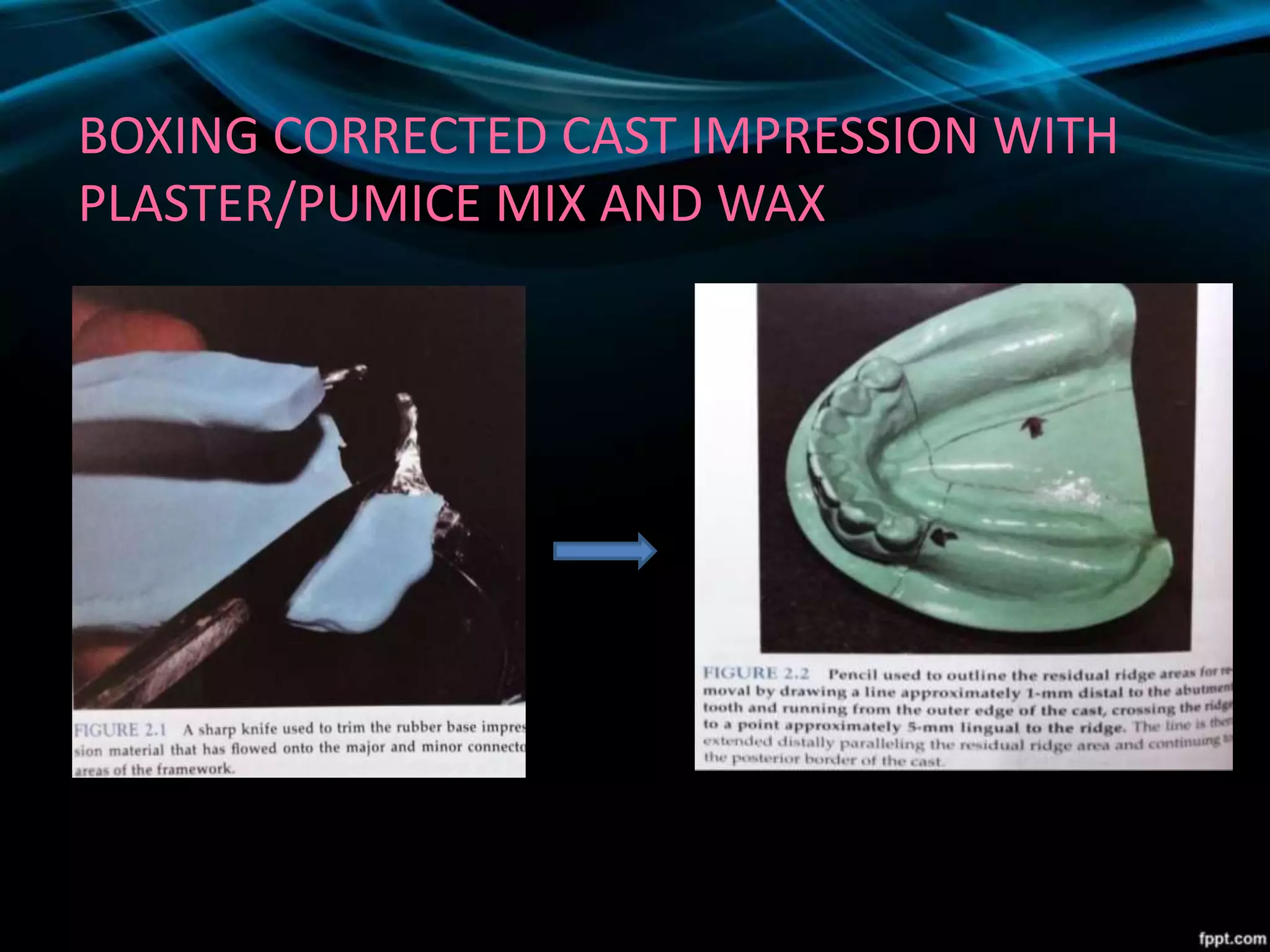 BOXING CORRECTED CAST IMPRESSION WITH
PLASTER/PUMICE MIX AND WAX
 
