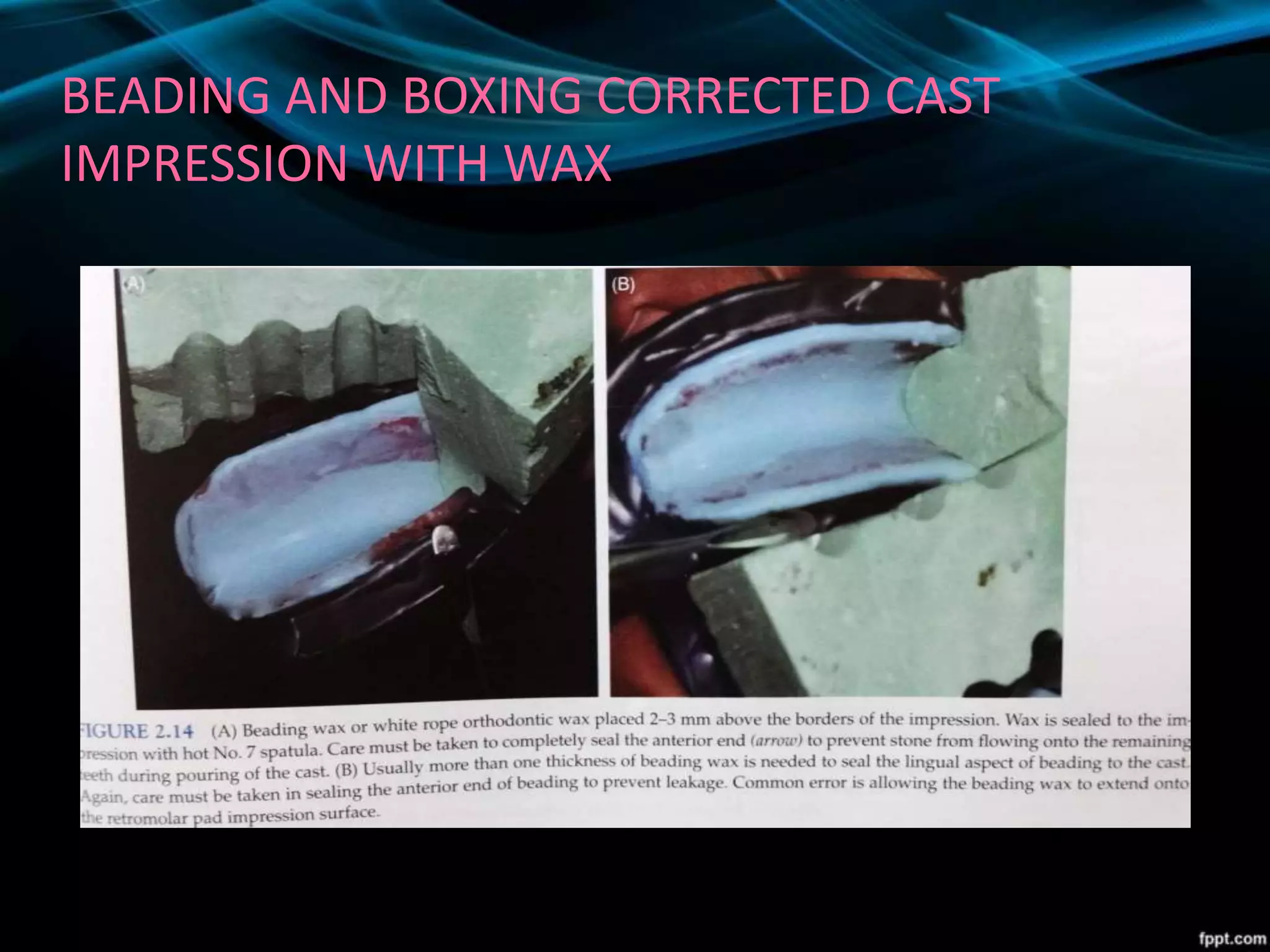 BEADING AND BOXING CORRECTED CAST
IMPRESSION WITH WAX
 