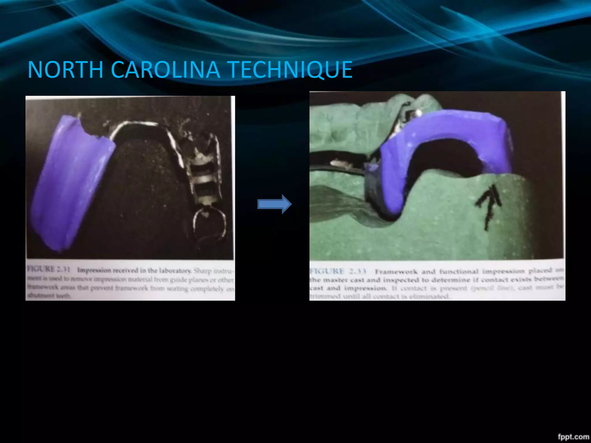 NORTH CAROLINA TECHNIQUE
 