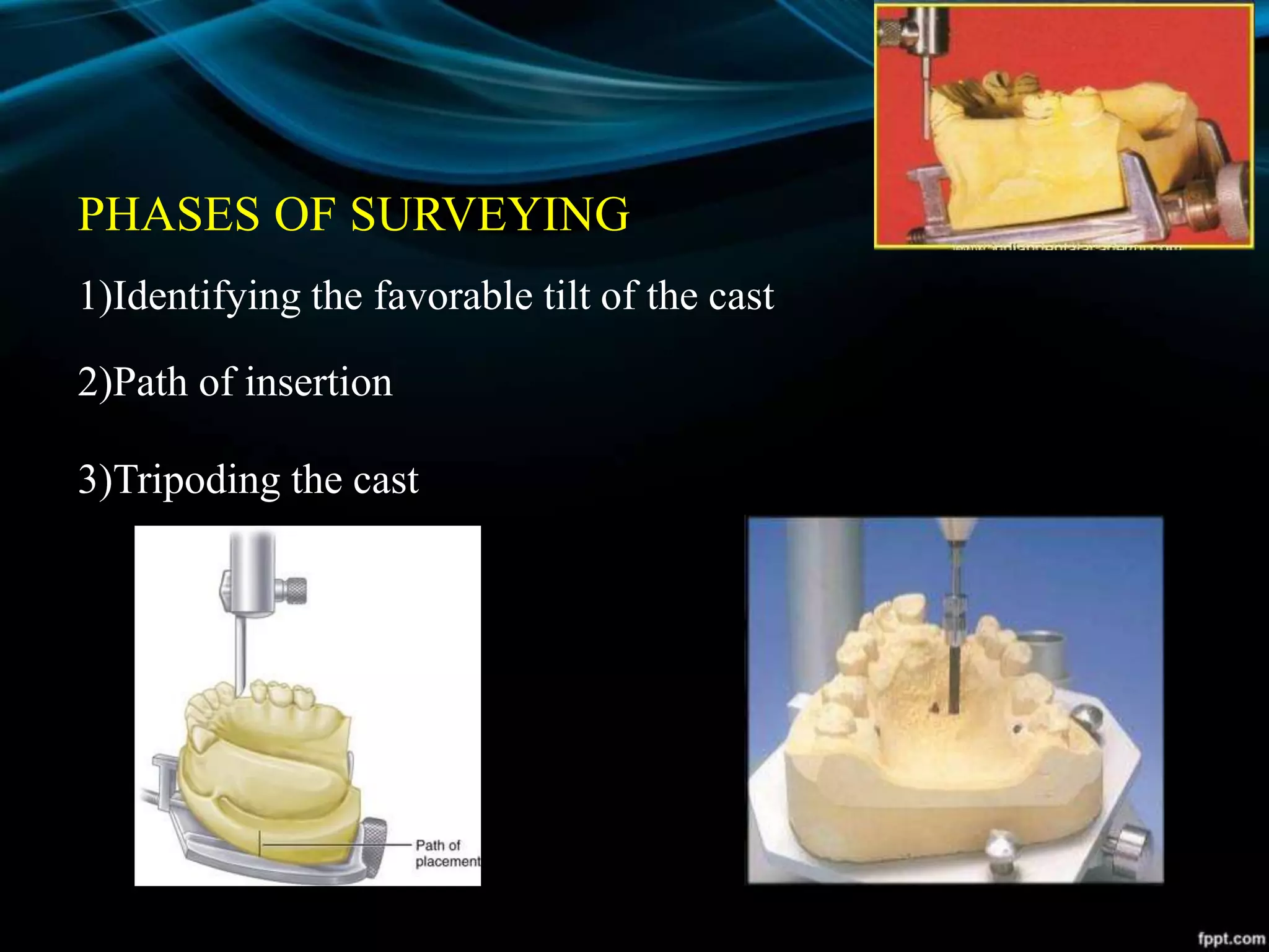 PHASES OF SURVEYING
1)Identifying the favorable tilt of the cast
2)Path of insertion
3)Tripoding the cast
 