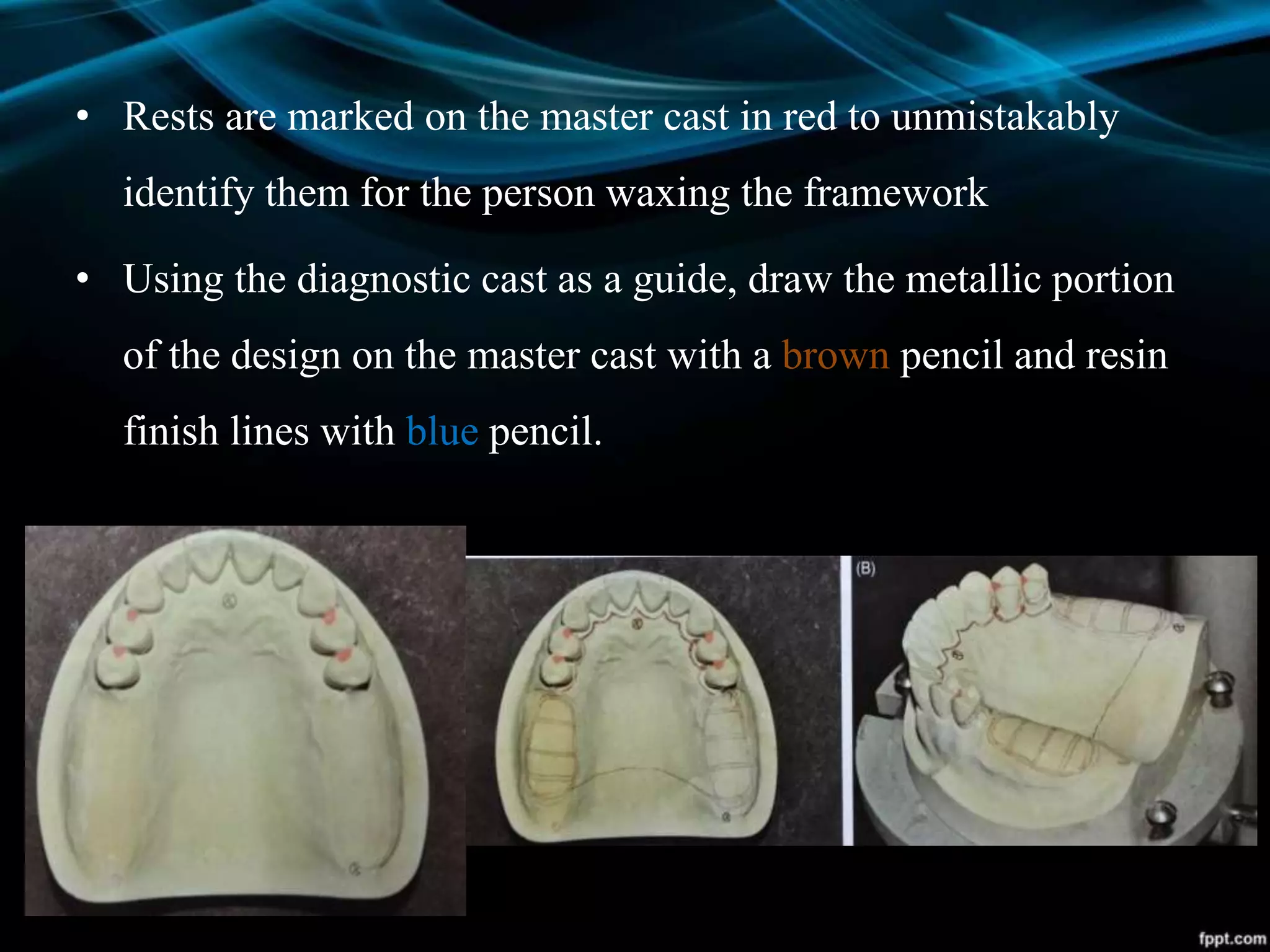 • Rests are marked on the master cast in red to unmistakably
identify them for the person waxing the framework
• Using the diagnostic cast as a guide, draw the metallic portion
of the design on the master cast with a brown pencil and resin
finish lines with blue pencil.
 
