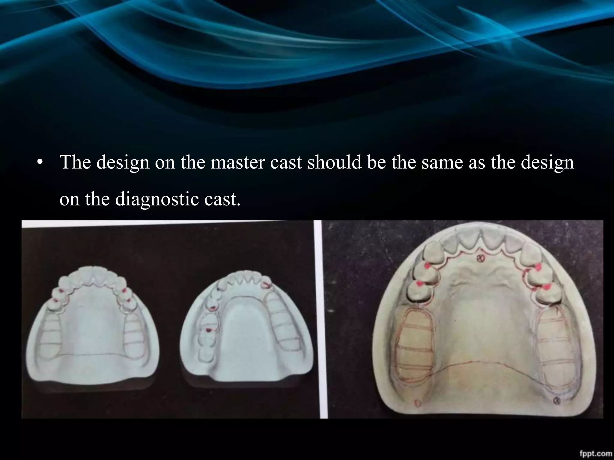 • The design on the master cast should be the same as the design
on the diagnostic cast.
 