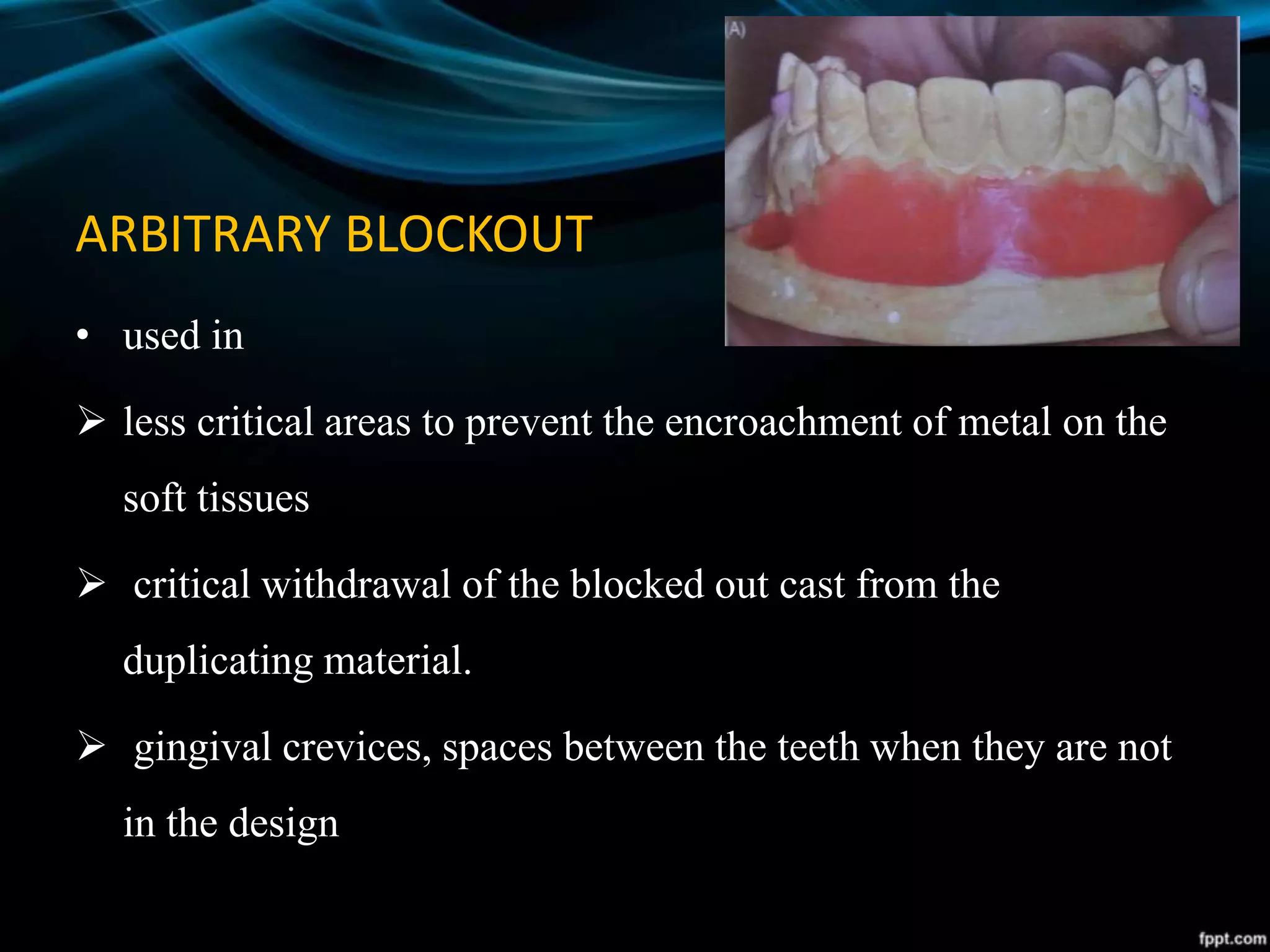 ARBITRARY BLOCKOUT
• used in
 less critical areas to prevent the encroachment of metal on the
soft tissues
 critical withdrawal of the blocked out cast from the
duplicating material.
 gingival crevices, spaces between the teeth when they are not
in the design
 
