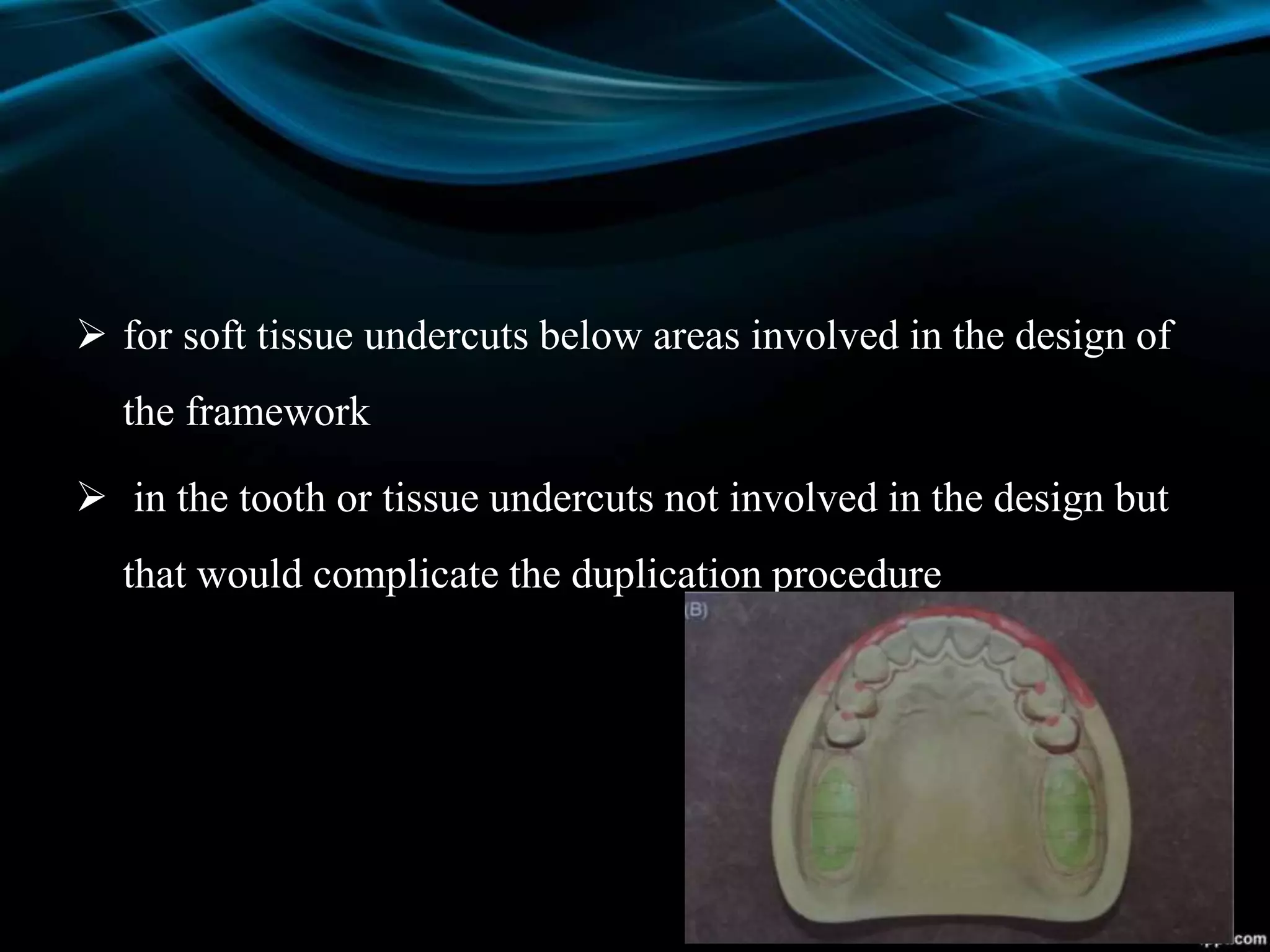 for soft tissue undercuts below areas involved in the design of
the framework
 in the tooth or tissue undercuts not involved in the design but
that would complicate the duplication procedure
 