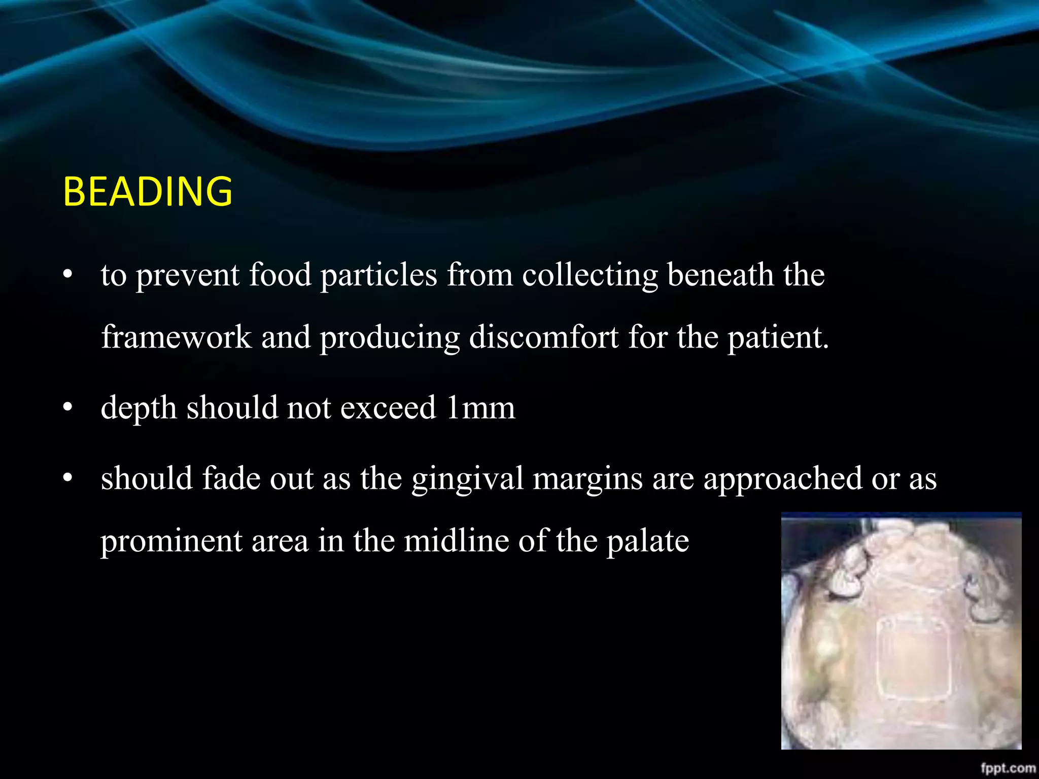 BEADING
• to prevent food particles from collecting beneath the
framework and producing discomfort for the patient.
• depth should not exceed 1mm
• should fade out as the gingival margins are approached or as
prominent area in the midline of the palate
 
