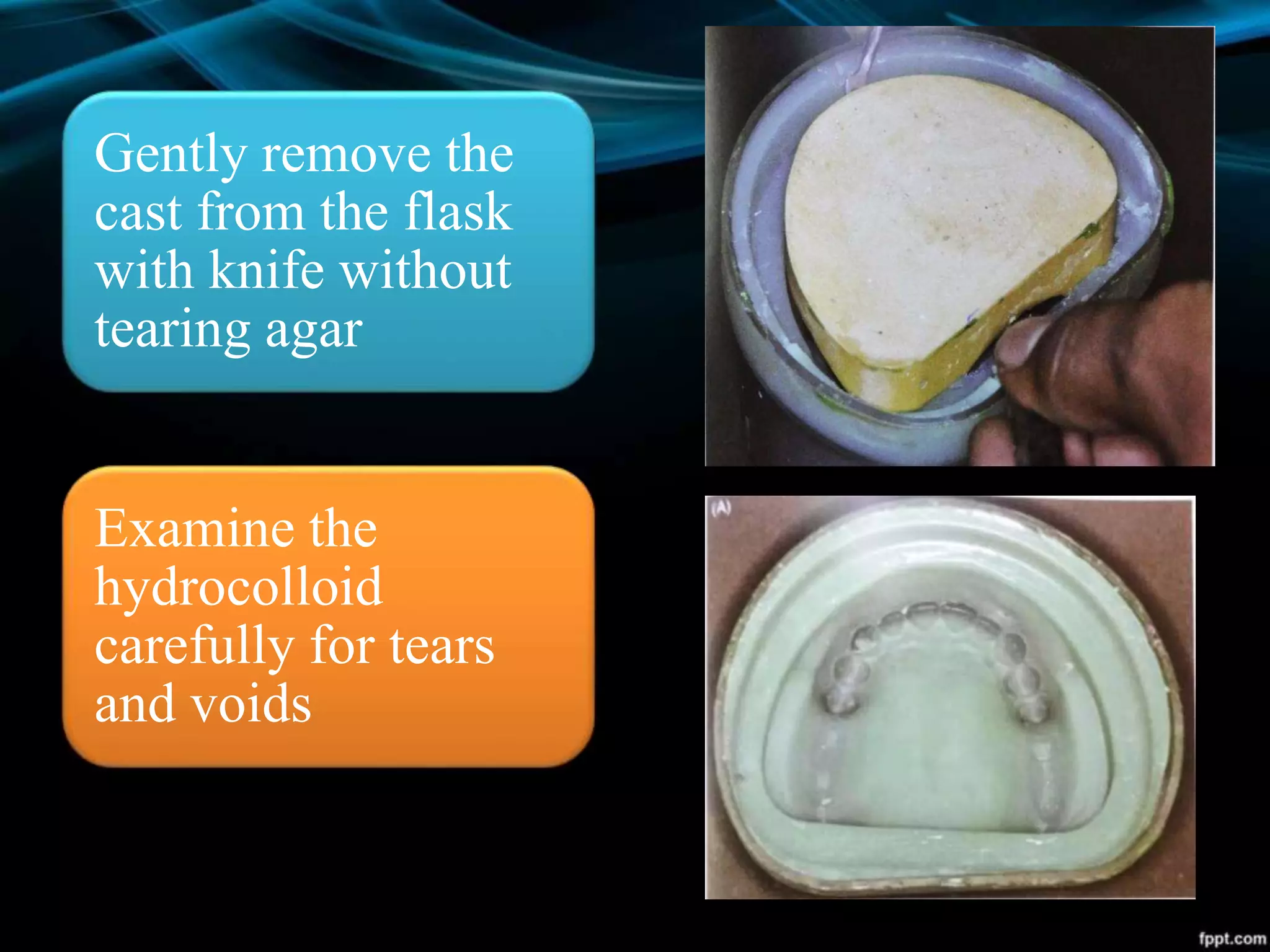 Gently remove the
cast from the flask
with knife without
tearing agar
Examine the
hydrocolloid
carefully for tears
and voids
 