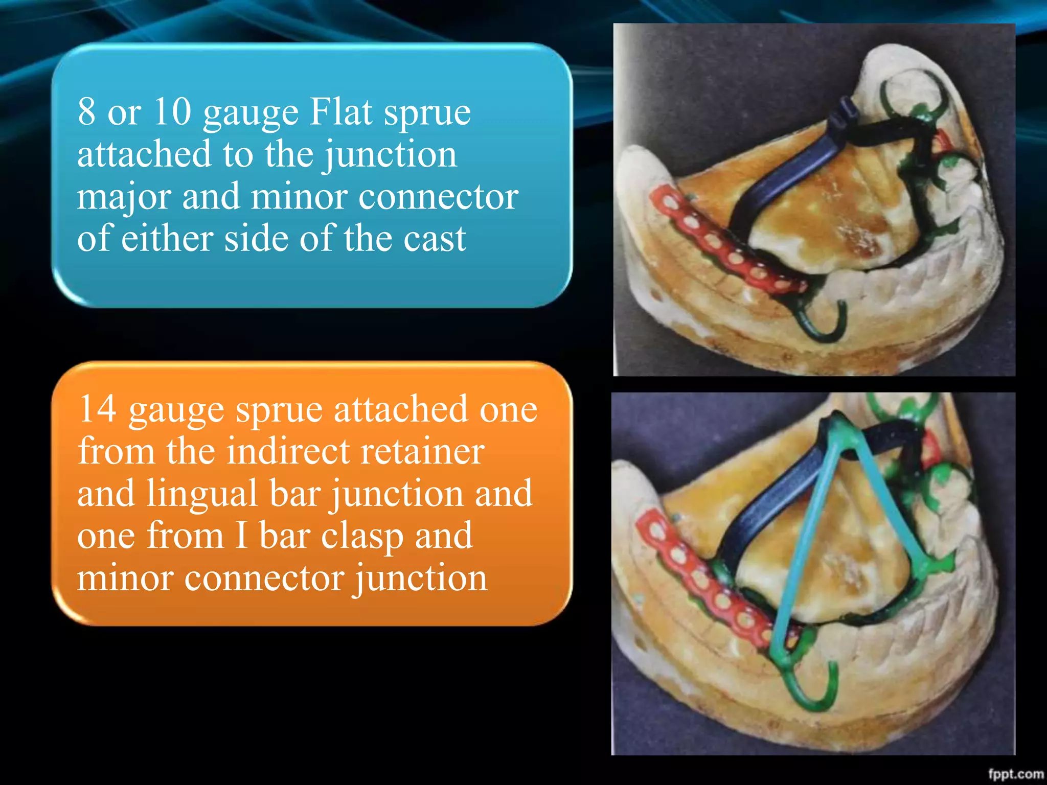 8 or 10 gauge Flat sprue
attached to the junction
major and minor connector
of either side of the cast
14 gauge sprue attached one
from the indirect retainer
and lingual bar junction and
one from I bar clasp and
minor connector junction
 