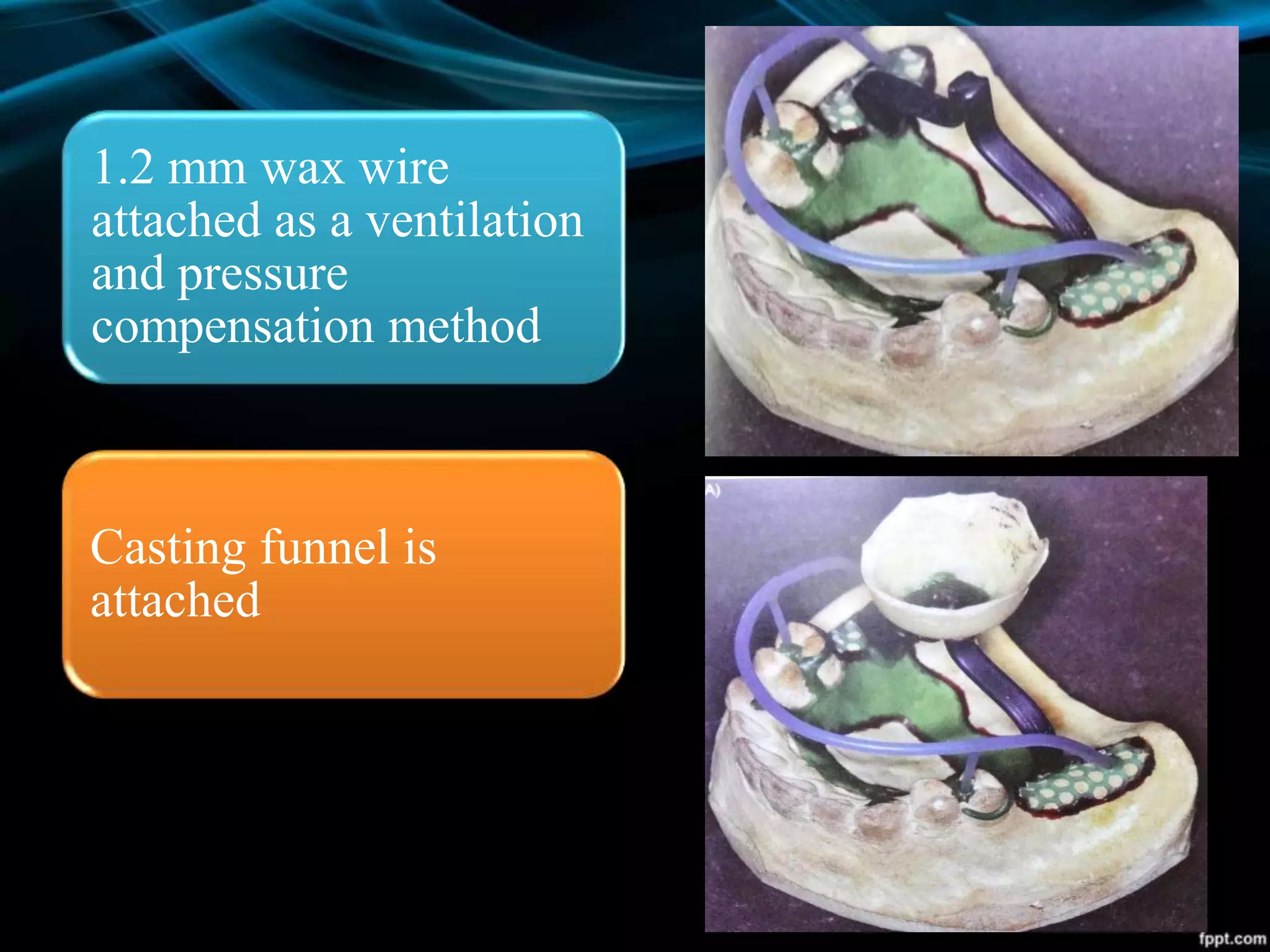 1.2 mm wax wire
attached as a ventilation
and pressure
compensation method
Casting funnel is
attached
 