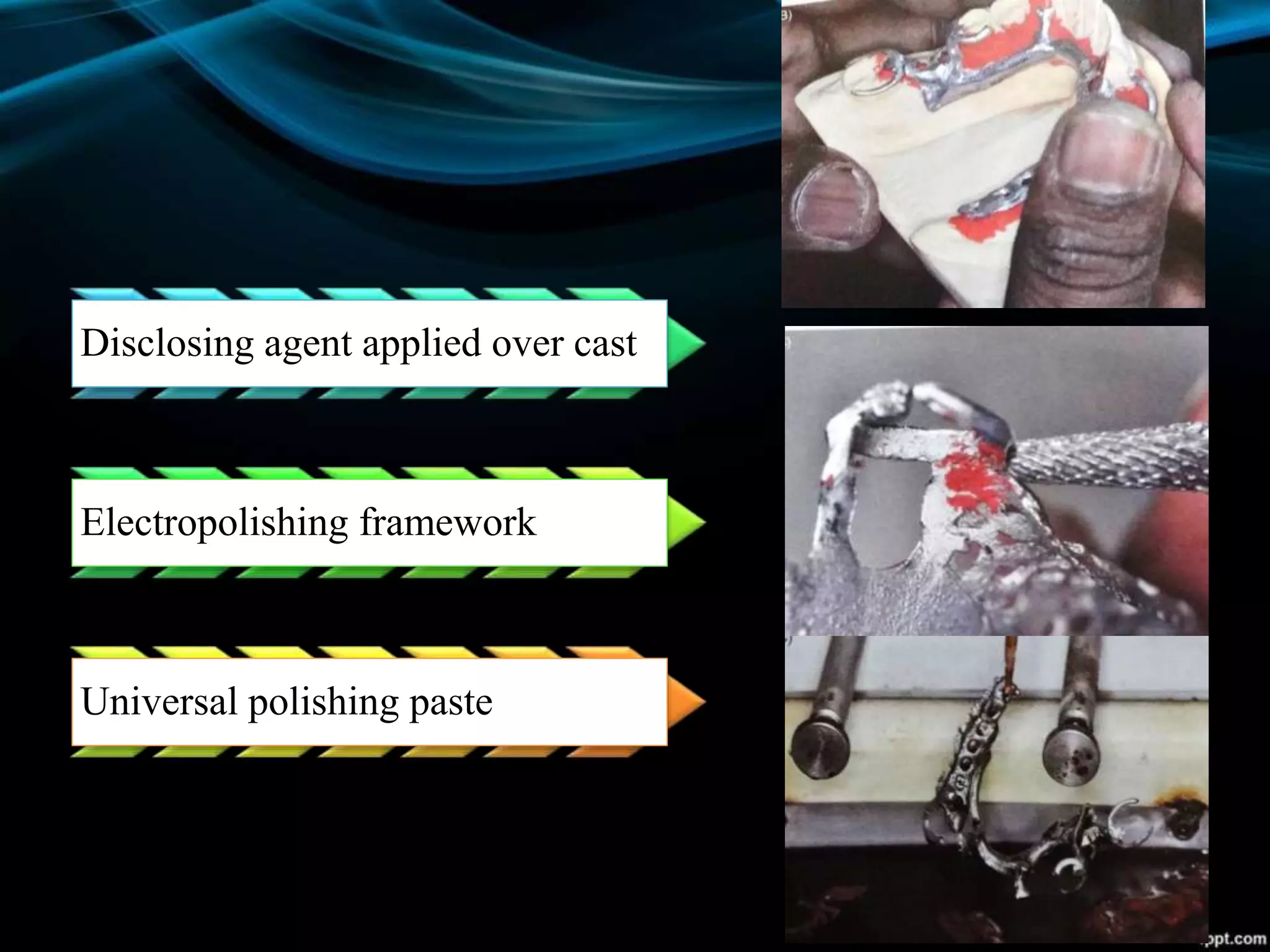 Disclosing agent applied over cast
Electropolishing framework
Universal polishing paste
 