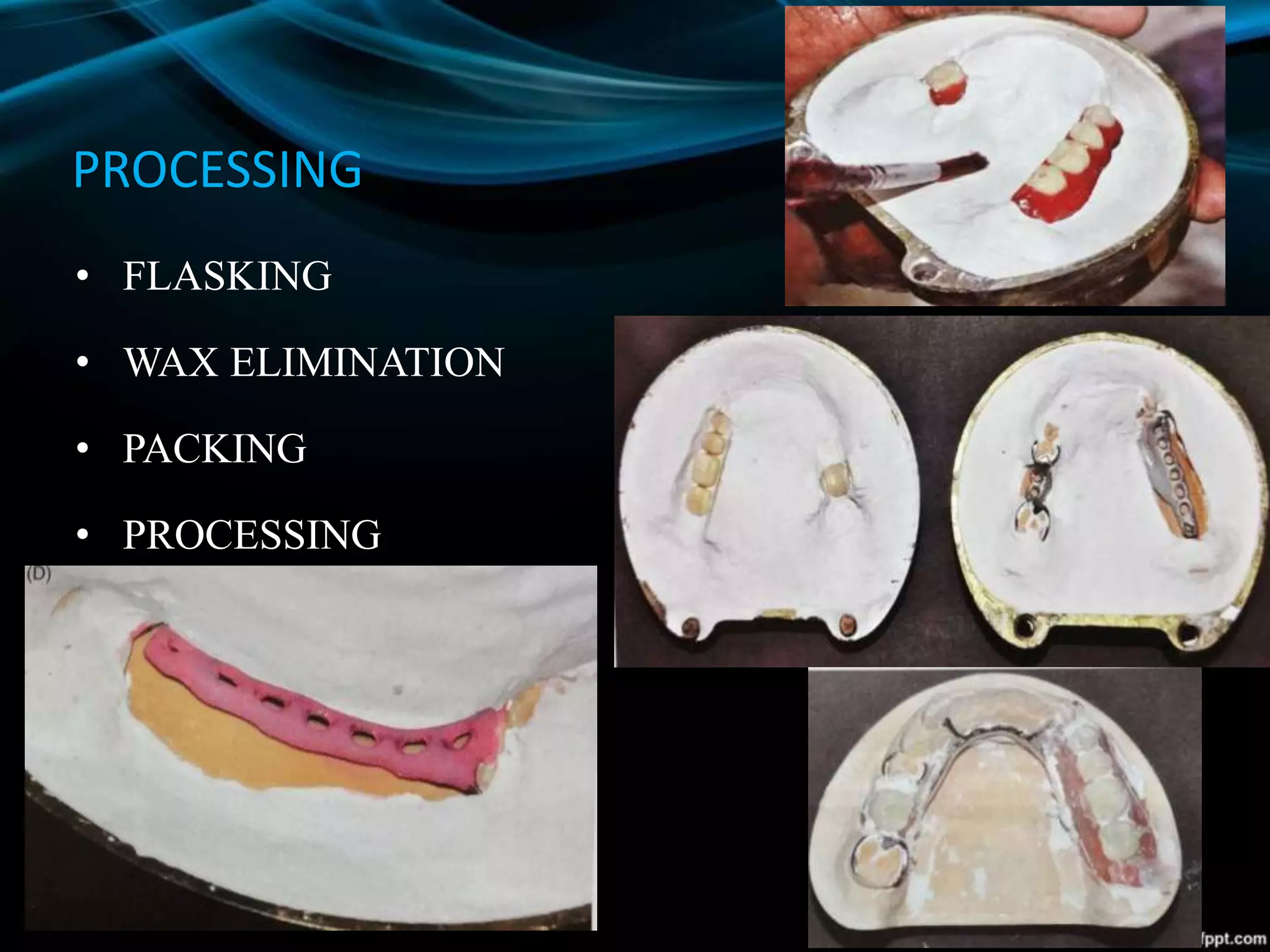 PROCESSING
• FLASKING
• WAX ELIMINATION
• PACKING
• PROCESSING
 