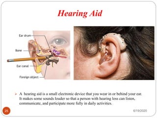 Hearing Aid
6/19/202025
 A hearing aid is a small electronic device that you wear in or behind your ear.
It makes some sounds louder so that a person with hearing loss can listen,
communicate, and participate more fully in daily activities.
 