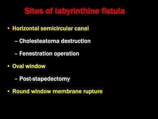 5. routine clinical tests of vestibular function kk | PPT