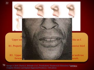 speech and it's importance in complete denture patients | PPTX