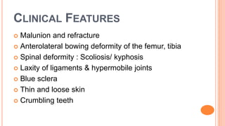 CLINICAL FEATURES
 Malunion and refracture
 Anterolateral bowing deformity of the femur, tibia
 Spinal deformity : Scoliosis/ kyphosis
 Laxity of ligaments & hypermobile joints
 Blue sclera
 Thin and loose skin
 Crumbling teeth
 