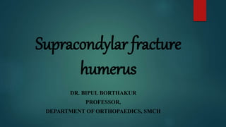 Supracondylar fracture
humerus
DR. BIPUL BORTHAKUR
PROFESSOR,
DEPARTMENT OF ORTHOPAEDICS, SMCH
 