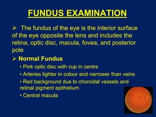 Ophthalmoscopy | PPT