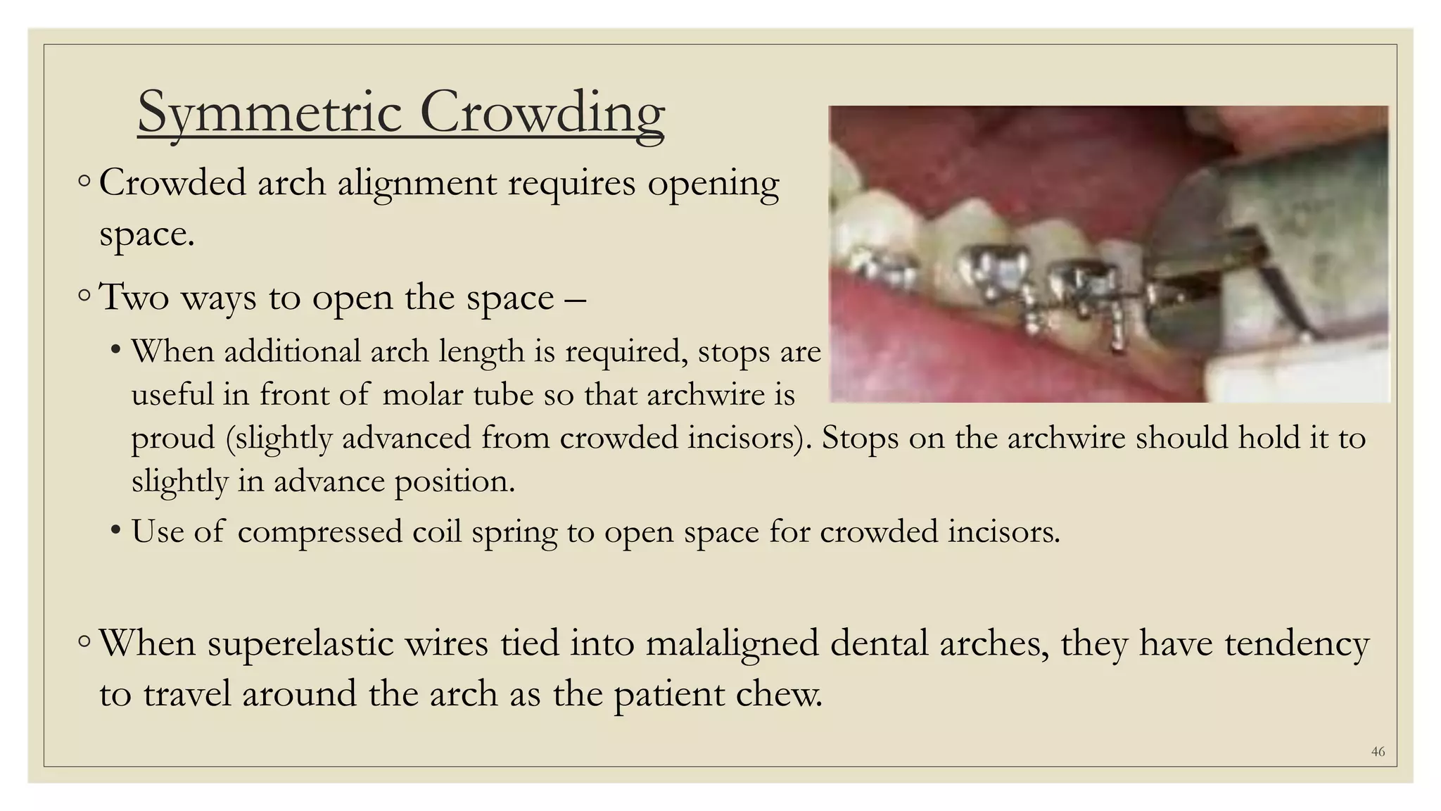 Leveling and Aligning | PPTX