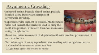 Asymmetric Crowding
◦ Impacted canine, buccally placed canine, palatally
blocked lateral incisors are examples of
asymmetric crowding.
◦ Superelastic wire segment or braided/Multistranded
wires tied beneath the bracket is used to bring the
tooth into position, while arch form was maintained
as it gives light force.
◦ Result is efficient movement of displaced tooth with excellent preservation of
arch wire form –
◦ Two advantages of using superelastic wire auxillary wire to rigid steel wire –
◦ 1. Control of the tendency to distort arch form
◦ 2. Light force against the tooth to be moved
47
 