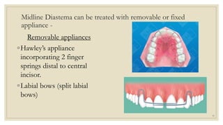 Midline Diastema can be treated with removable or fixed
appliance -
Removable appliances
◦Hawley’s appliance
incorporating 2 finger
springs distal to central
incisor.
◦Labial bows (split labial
bows)
55
 