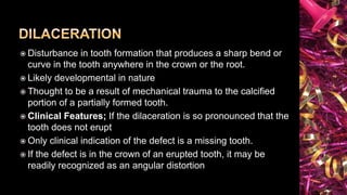 Sharp Linear Defect Tooth Radiographic Interpretation of Dental Anomalies | PPTX